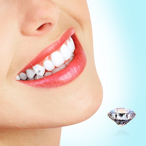 ẢNH MINH HỌA QUY TRÌNH ĐÍNH ĐÁ VÀO RĂNG AN TOÀN KHÔNG ĐAU