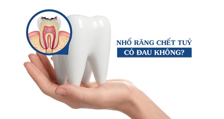 Nhổ răng chết tuỷ có đau không?
