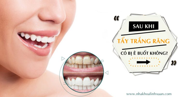 Tẩy trắng răng có bị ê buốt không