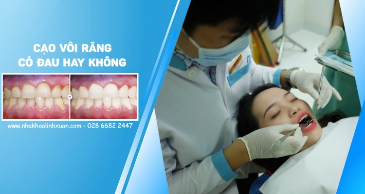 Cạo vôi răng có đau không