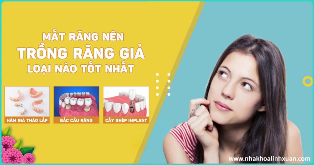 Nên trồng răng giả loại nào tốt nhất - Nha Khoa LINH XUÂN