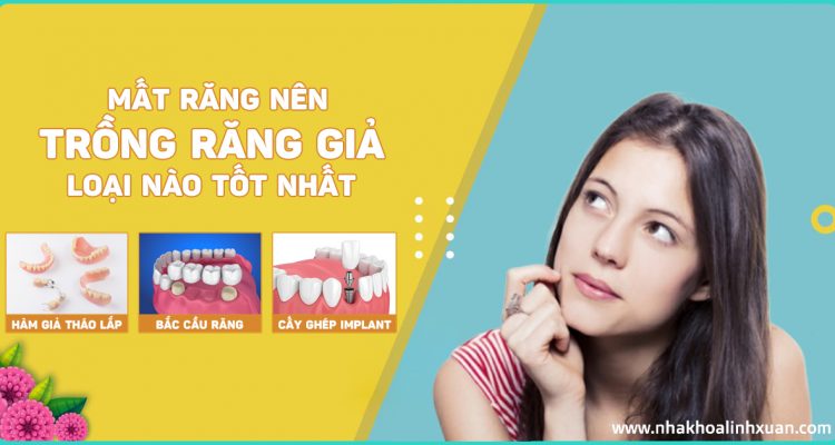 Nên trồng răng giả loại nào tốt nhất