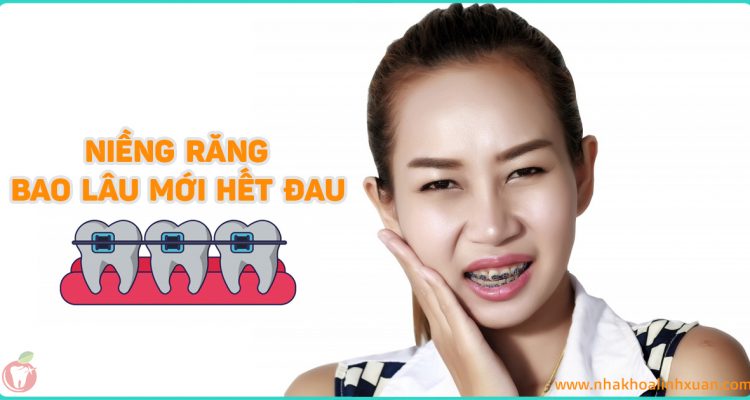 Niềng răng bao lâu thì mới hết đau