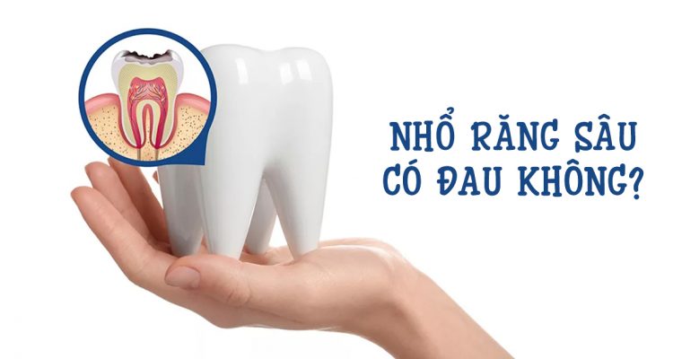 Nhổ răng sâu có đau không