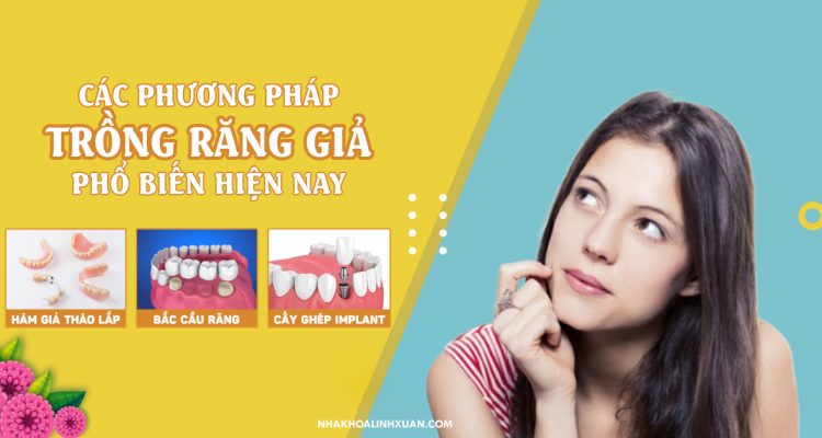 Các phương pháp trồng răng giả