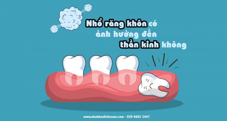 Nhổ răng khôn có ảnh hưởng thần kinh không