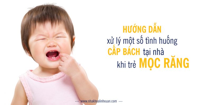 Xử lý tình huống trẻ mọc răng