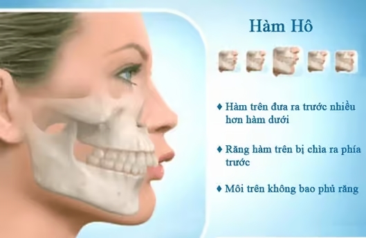 Hô hàm