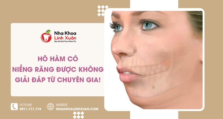 Hô hàm có thể niềng răng không