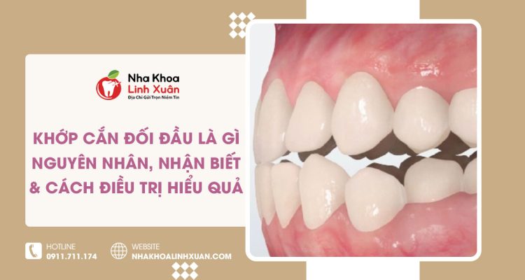 Khớp cắn đối đầu là gì? Nguyên nhân & cách khắc phục