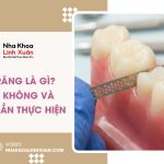 Mài kẽ răng là gì? Có đau không và khi nào cần thực hiện
