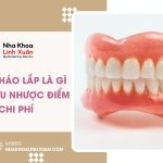 Hàm giả tháo lắp là gì? Cấu tạo, ưu nhược điểm & chi phí