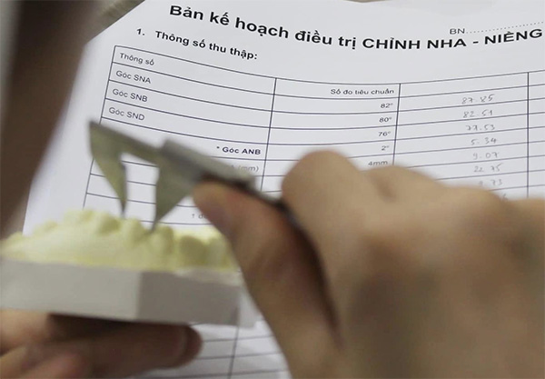 Lập kế hoạch niềng răng