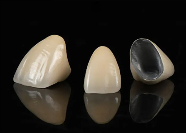 Răng sứ Titanium