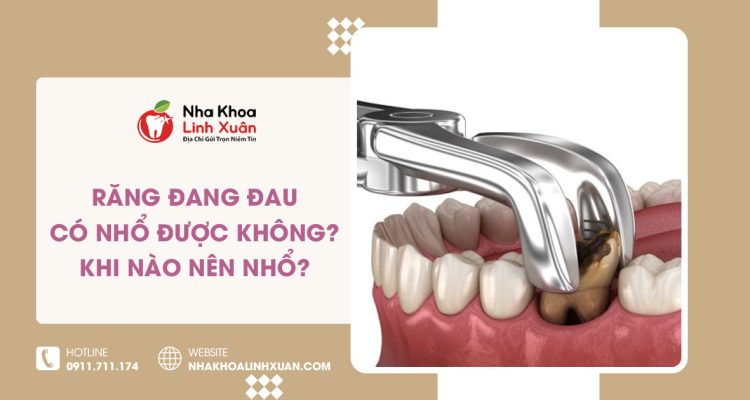 Răng đang đau có nhổ được không? Khi nào nên nhổ?