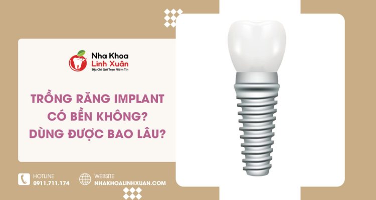 Trồng răng Implant có bền không? Dùng được bao lâu?